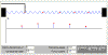 cadenaForzadas.gif (5842 bytes)